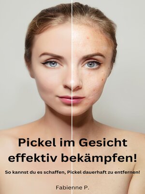 cover image of Pickel im Gesicht effektiv bekämpfen!